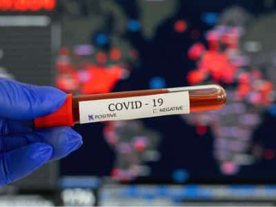 FFUC-PCR-Testing-Decipher-Results-COVID-19-400x300