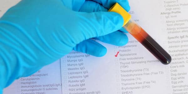 Family-First-Urgent-Care-Conroe-Mens-Health-Services-Testosterone-Thyroid-Adrenal-Testing-600x300