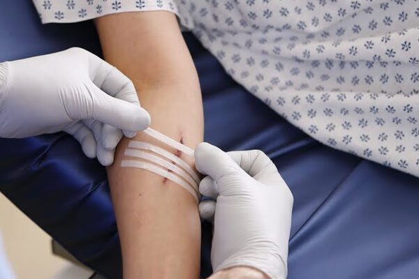 Minor Emergency Cuts And Lacerations