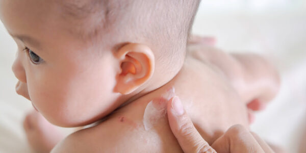 Pediatric Skin Infections