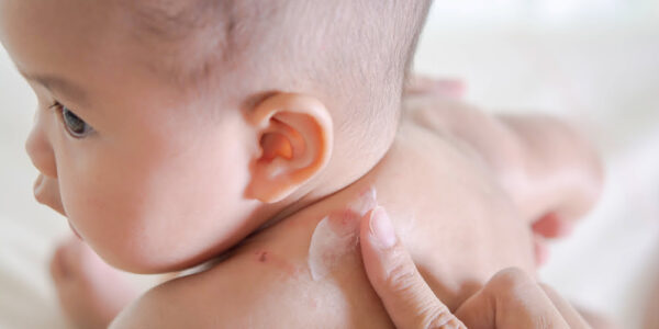 Pediatric Skin Infections Pediatric Skin Infections
