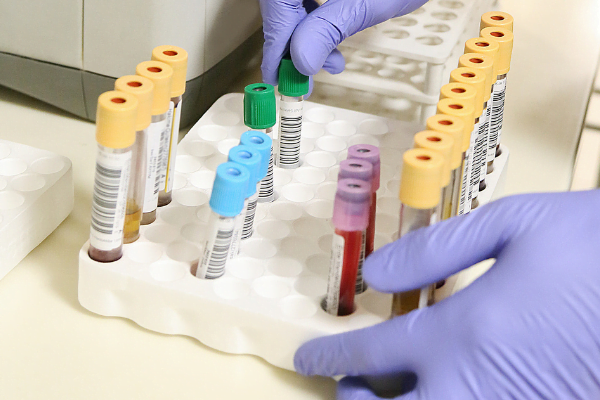 Family-First-Urgent-Care-Conroe-Medical-Solutions-Businesses-Lab-Services-600x500 Family-First-Urgent-Care-Conroe-Medical-Solutions-Businesses-Lab-Services-600x500