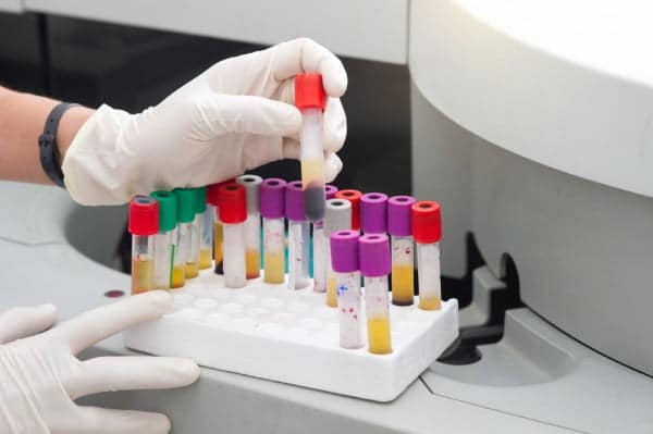 Blood Screening