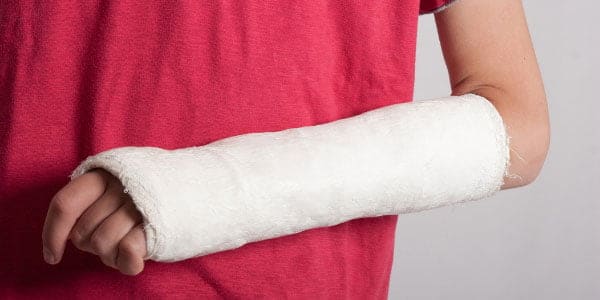 Family-First-Urgent-Care-Conroe-Minor-Emergency-Services-Fractures-600x300