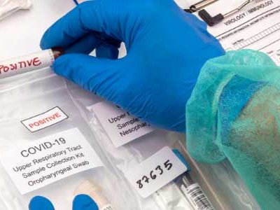 FFUC-PCR-Testing-Gold-Standard-COVID-Testing-Results-600x300 FFUC-PCR-Testing-Gold-Standard-COVID-Testing-Results-600x300