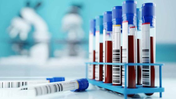 Blood Testing for Nutrition and Genetics