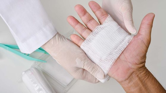 Do I Need Stitches? - Family First Urgent Care Conroe